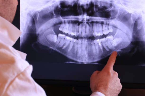 Best Cosmetic Emergency Dentistry in Lakeside, OR